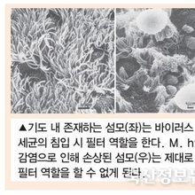 호흡기 질병 컨트롤의 핵심, 마이코플라즈마 하이오뉴모니아(M. hyo) / 정종연 수의사