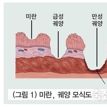 양돈장의 늘어난 가을철 불청객 : 위궤양 / 박건욱 원장